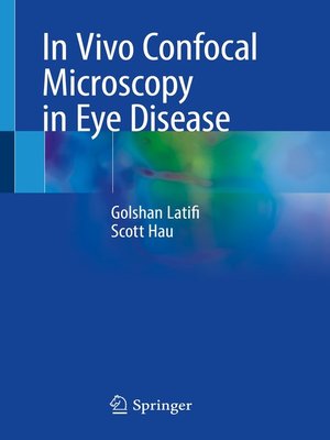 cover image of In Vivo Confocal Microscopy in Eye Disease